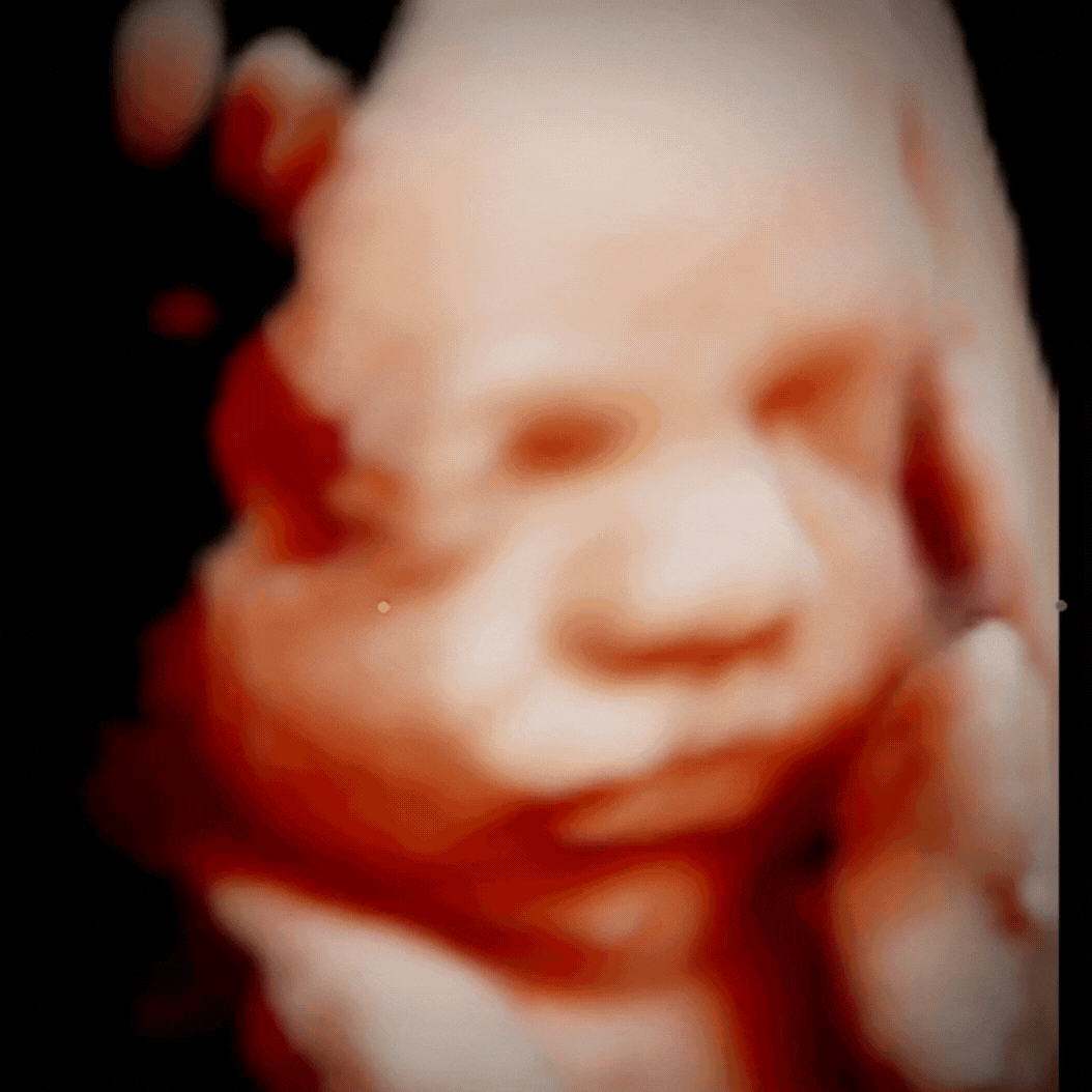 Package 2 (1 image, 1 transition video)